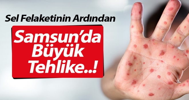 Samsun’da Sel Felekatinin Ardından Bulaşıcı Hastalık Tehlikesi