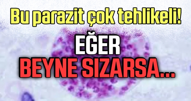 Bu Parazit Çok Tehlikeli! Eğer Beyne Sızarsa Durum Ağırlaşır