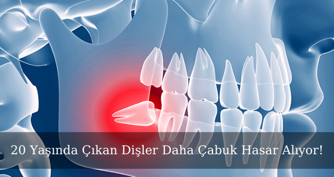 20 Yaşında Çıkan Dişler Daha Çabuk Hasar Alıyor!