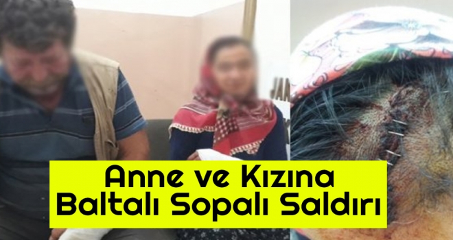 Anne ve Kızına Baltalı Sopalı Saldırı